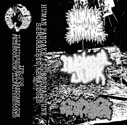 Human Pancake : Human Pancake - Duodenal Junk - Seborrheic Keratosis